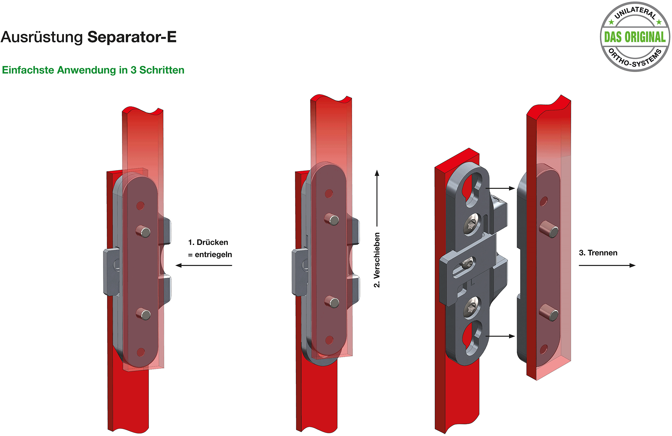 Ausstattung und Vorteile des Separator-E