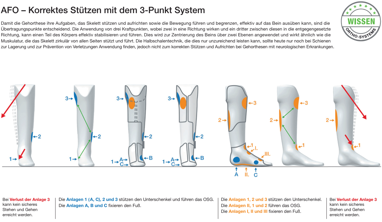 AFO 3-Punkt System - Bild1