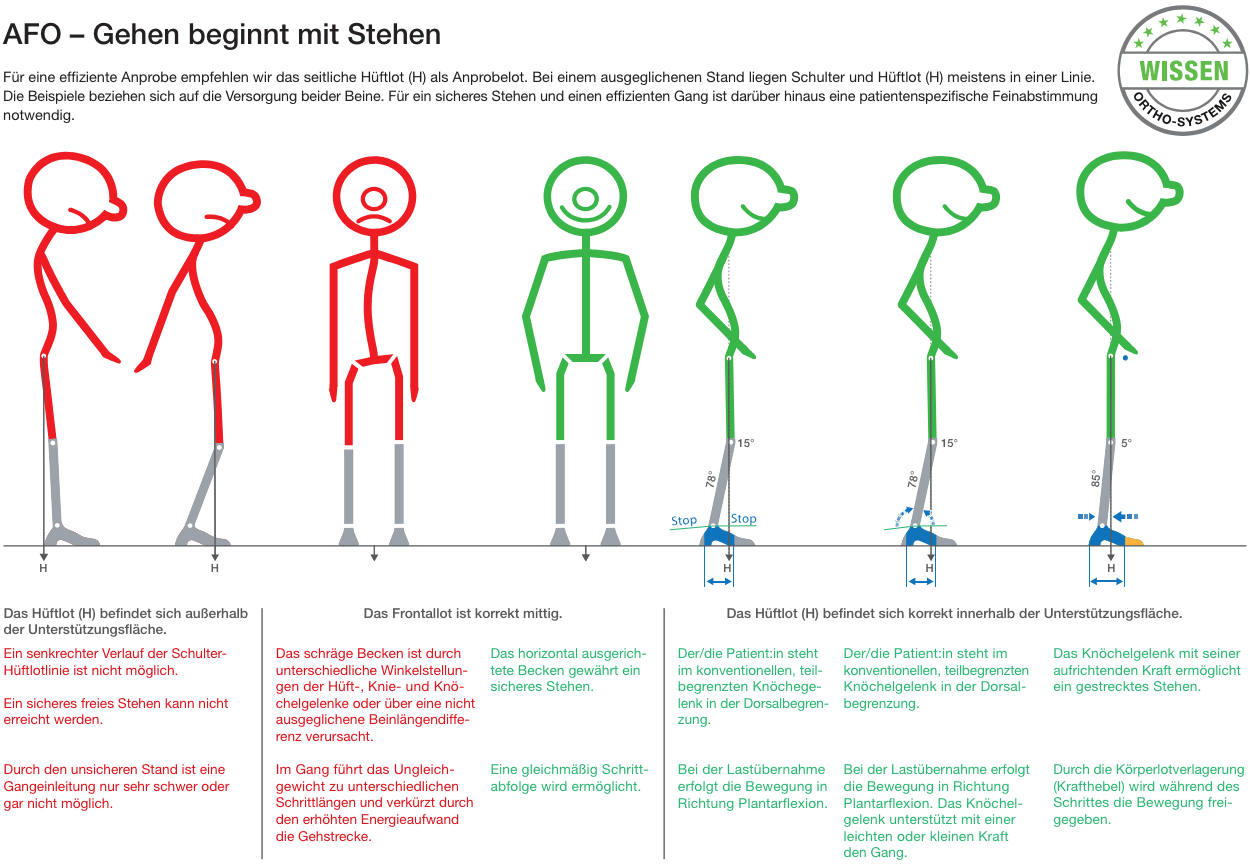 AFO 3-Punkt System - Bild2