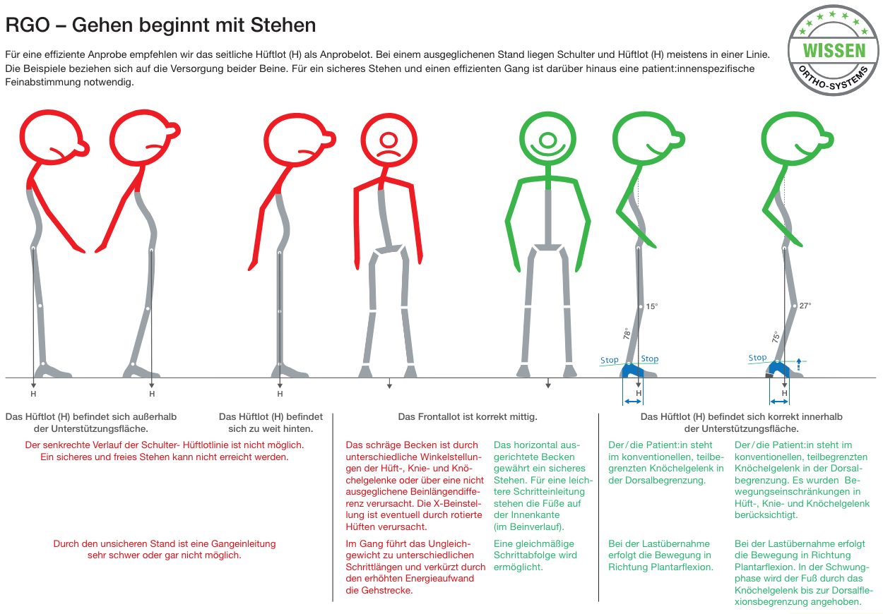 RGO 3-Punkt-System - Bild2