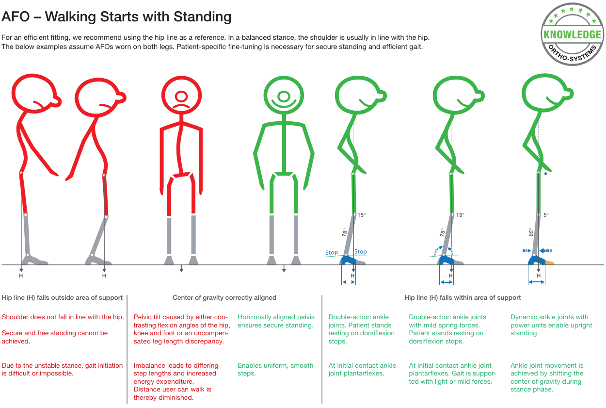 Afo 3-point system - Image 2